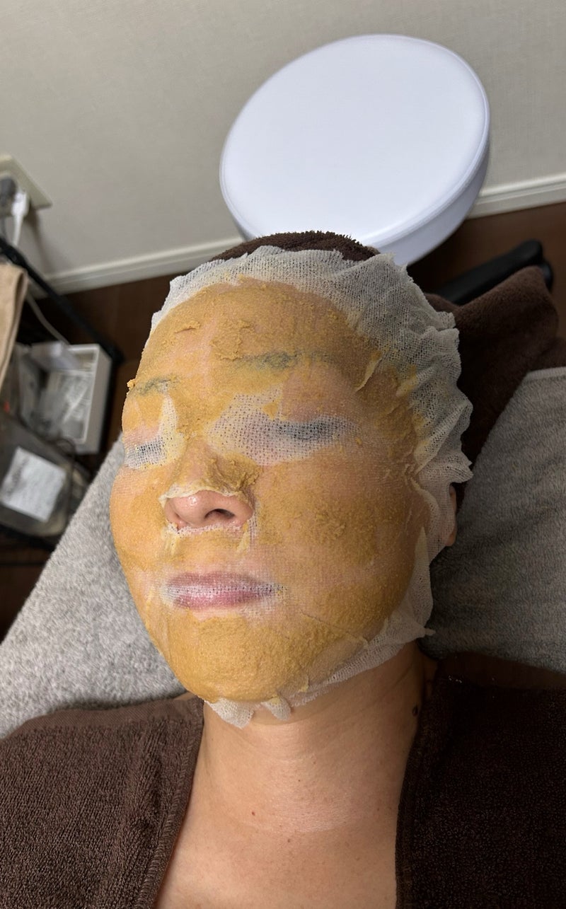 ニキビ・肌荒れにお悩み方の為の肌質改善エステ！エンジェルムーングループ